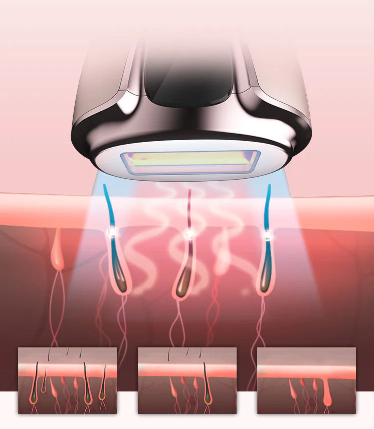 Laser Hair Removal Device for Home Use (Full Body)